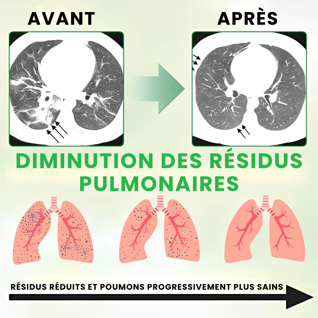 ODEIUN® – Spray Nettoyant des Poumons à la Molène 3X Concentrée - Détox Respiratoire Avancée & Respiration Plus Dégagée