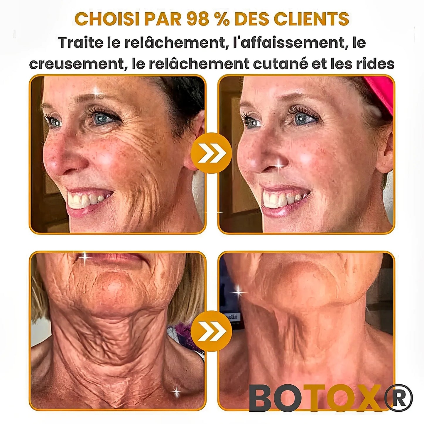 BOTOX® – Réduisez les rides en 2 minutes – Sérum anti-âge rapide et efficace – Économisez du temps et de l’argent