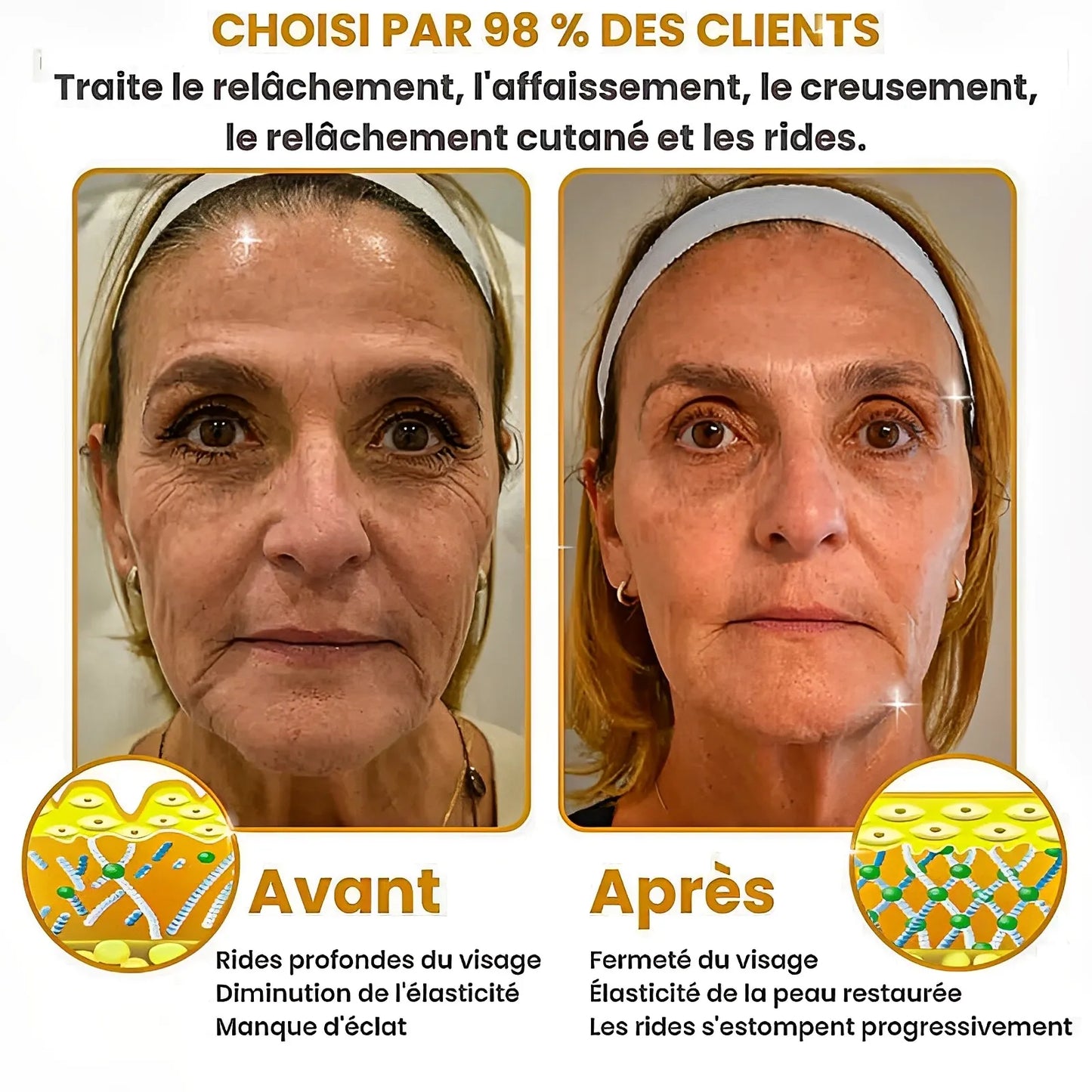BOTOX® – Réduisez les rides en 2 minutes – Sérum anti-âge rapide et efficace – Économisez du temps et de l’argent