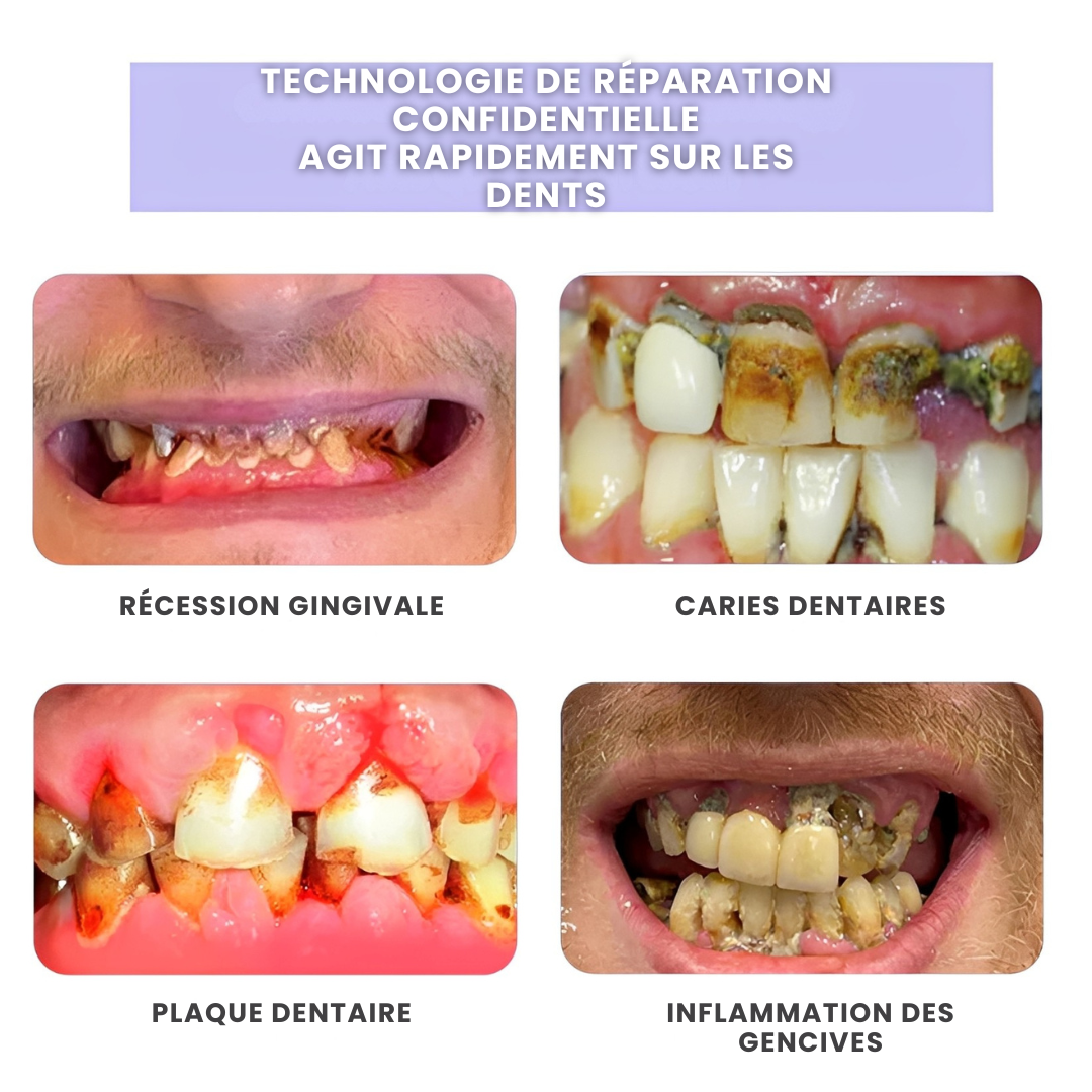 ODALIT™ – Réparation dentaire à domicile – Poudre minérale pour dents et gencives – Soulage parodontite, aphtes et inflammations
