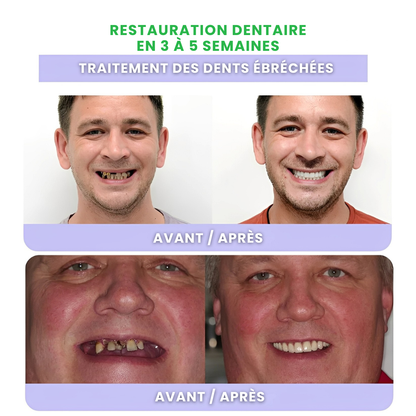 ODALIT™ – Réparation dentaire à domicile – Poudre minérale pour dents et gencives – Soulage parodontite, aphtes et inflammations