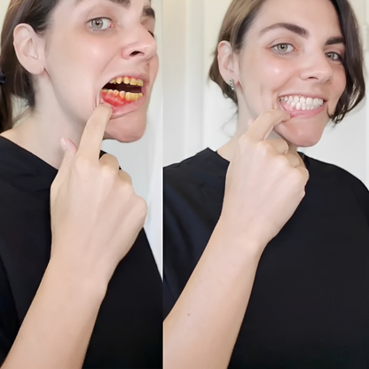 ODALIT™ – Réparation dentaire à domicile – Poudre minérale pour dents et gencives – Soulage parodontite, aphtes et inflammations