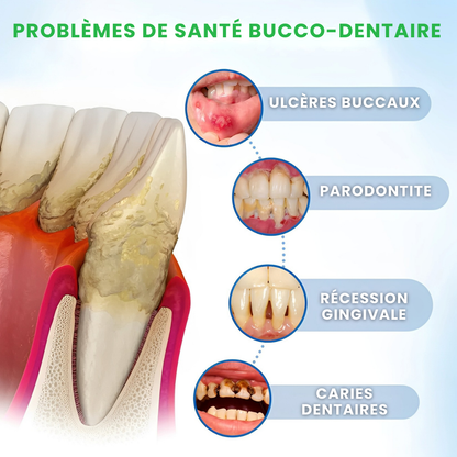 Sérum de Défense Dentaire LBMLBM™ – Protection Avancée & Renforcement Visible de l’Émail