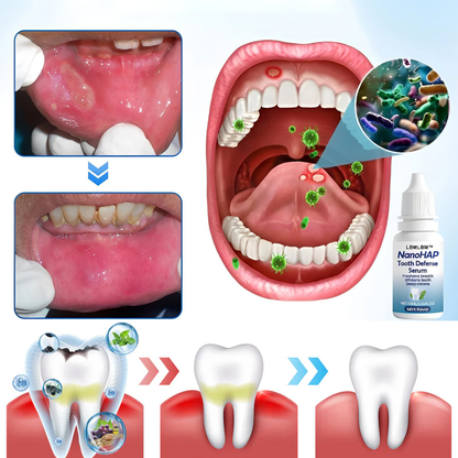 Sérum de Défense Dentaire LBMLBM™ – Protection Avancée & Renforcement Visible de l’Émail