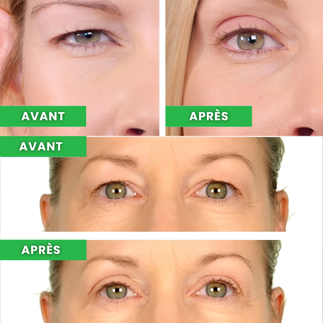 One® – Rehaussez vos paupières en 2 minutes – Effet lifting instantané – Économisez temps et argent