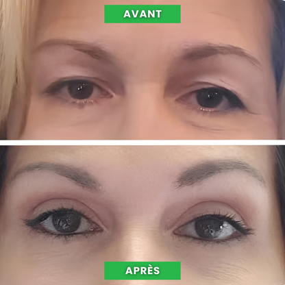 One® – Rehaussez vos paupières en 2 minutes – Effet lifting instantané – Économisez temps et argent