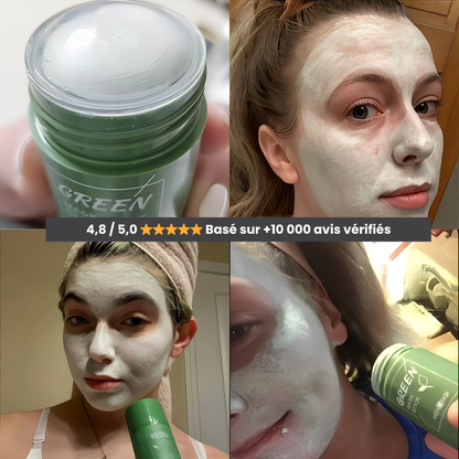 MASK® – Le Stick Nettoyant qui Élimine les Points Noirs en 10 Minutes